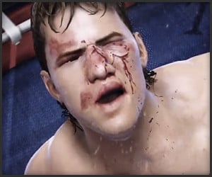 Fight Night Champion: Damage