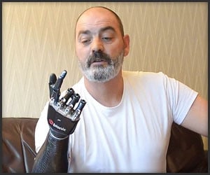 BeBionic3 Robotic Hand