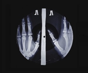 X-Ray Audio
