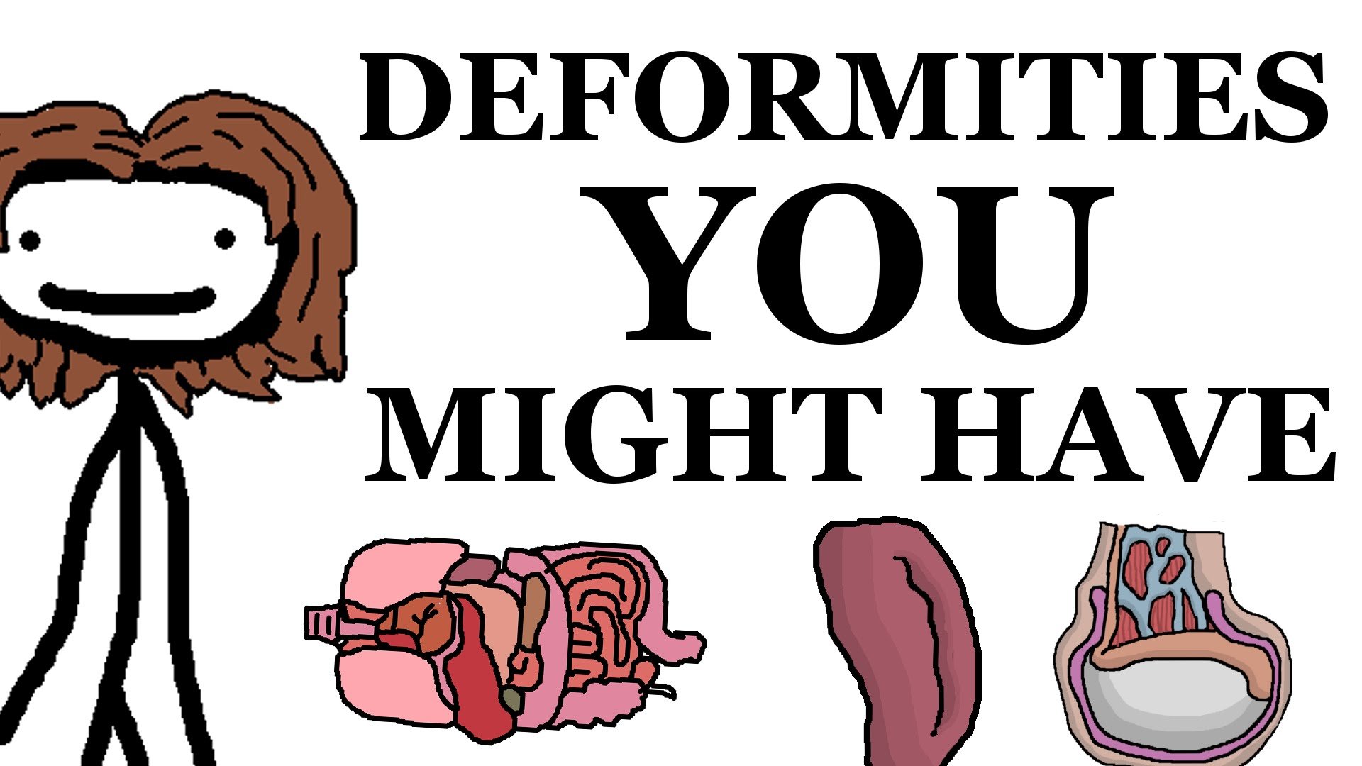 deformities-that-you-might-have