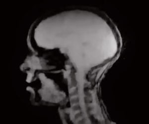 Singing in an MRI
