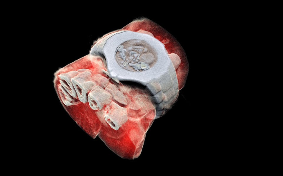 World’s First Full Color 3D X-Rays