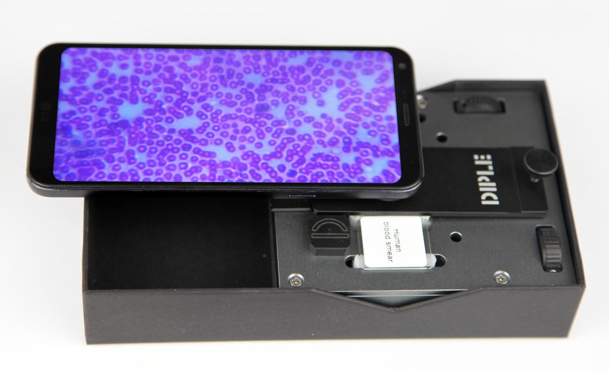 Diple Turns Your Smartphone into a Powerful Microscope