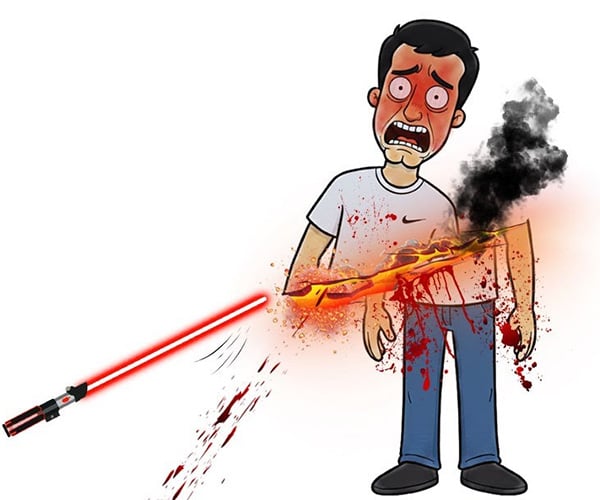If You Actually Got Struck by a Lightsaber